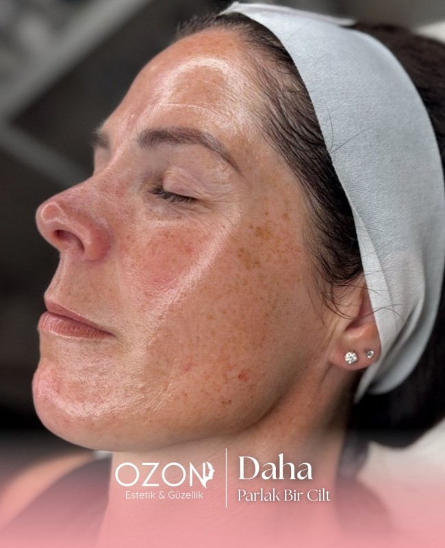 Ozon Estetik | Ankara Güzellik ve Estetik Merkezi