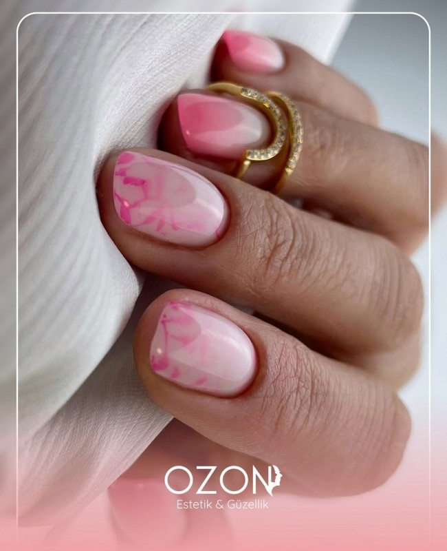 Ozon Estetik | Ankara Güzellik ve Estetik Merkezi